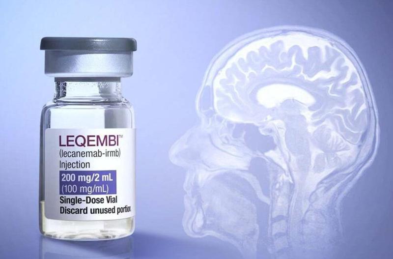 FDA-მ ალცჰაიმერის საწინააღმდეგო პირველი წამალი დაამტკიცა - რა არის ცნობილი Leqembi-ს შესახებ და რა იქნება მისი ფასი ამერიკულ ბაზარზე
