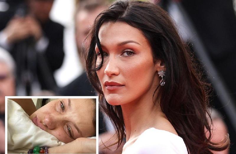 ალკოჰოლიზმი, თუ ლაიმის დაავადება? - მედიის ცნობით, ბელა ჰადიდი სარეაბილიტაციო ცენტრშია