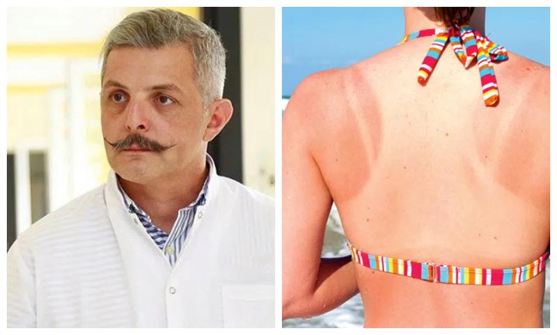 "ძალიან ბევრი დაავადების დროს მზეზე გასვლა აკრძალულია" - რა შეიძლება მოჰყვეს მზისგან დამწვრობას და როგორ ვუმკურნალოთ მას სახლის პირობებში: გუგა ქაშიბაძის რჩევები