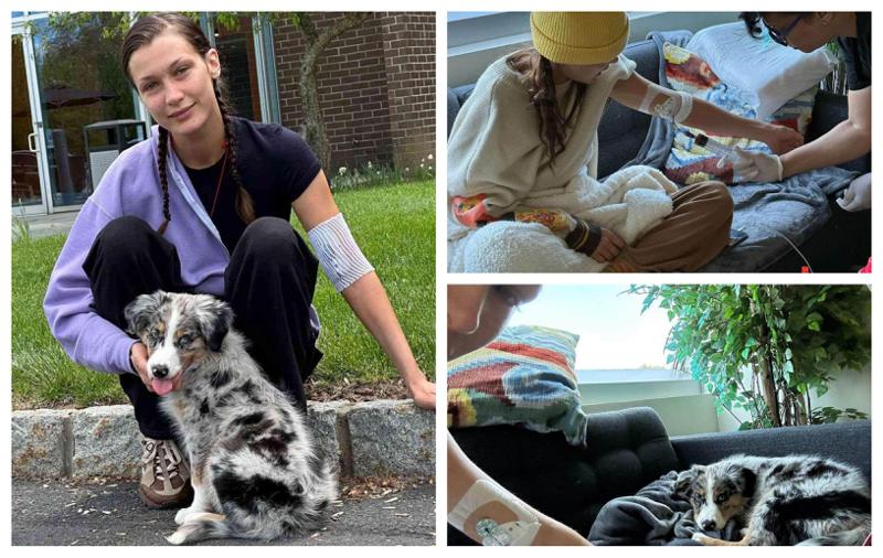 კლინიკა, მკურნალობა, მრავალწლიანი ტანჯვა - რა დაემართა ბელა ჰადიდს? მოდელი თავის მდგომარეობაზე წერს