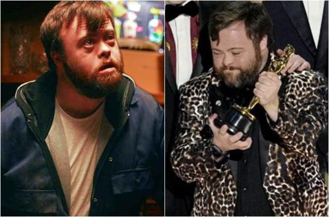 "ის, რომ დაუნის სინდრომი მაქვს, არაფერს ცვლის. მთავარია იმას ვაკეთებ, რაც მომწონს..." - გაიცანით ჯეიმს მარტინი, რომელმაც "ოსკარის" ჯილდოს მიღება შეძლო