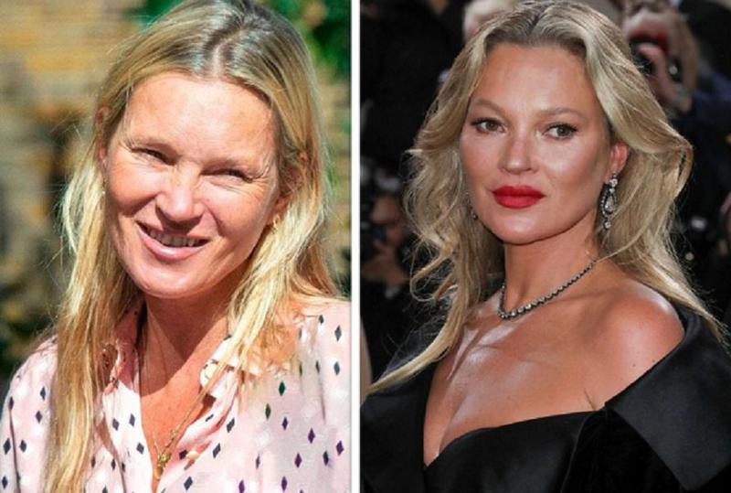 "ოქროს თაობის" სუპერმოდელის შეცვლილი გარეგნობა - კეიტ მოსის პაპარაცული ფოტოები, სადაც გულშემატკივრებმა ვერ იცნეს