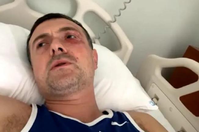 "დაზიანებები მაქვს თავის, სახის და მხრების არეში, დღეს უფრო ვერ ვარ კარგად... როგორც ვატყობ, კლინიკიდან დღეს არ გამწერენ" - ირაკლი ეძგვერაძე