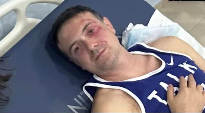 პროკურატურამ თბილისის საკრებულოს დეპუტატზე ჯგუფურად ჩადენილი ძალადობის საქმეზე დაკავებულ 6 პირს ბრალდება წარუდგინა