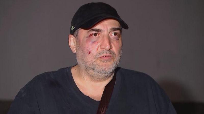 გაფრთხილება მედიას თუ პირადი ანგარიშსწორება? - რას აჩვენებს მიშა მშვილდაძეზე თავდასხმის საქმე