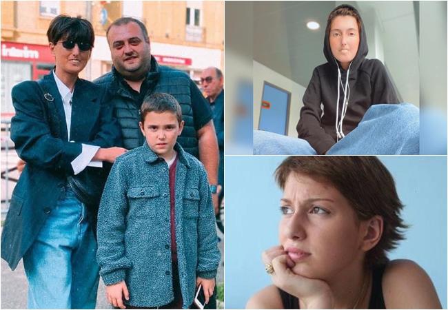 "მეკითხებიან, კბილები რატომ გაქვს ასე, გაკეთებას არ აპირებო? მირჩევენ, ტუჩებზე ფილერი გავიკეთო" - ცხოვრება სკლეროდერმიის დიაგნოზით: ქალი, რომელიც უიშვიათეს დაავადებას ებრძვის