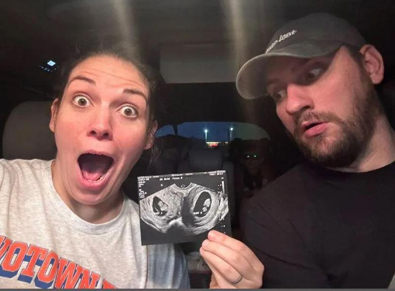 ქალი ორი საშვილოსნოთი და ორივეთი ორსულად - უნიკალური მოვლენა, რომელიც 50 მილიონში ერთხელ ხდება