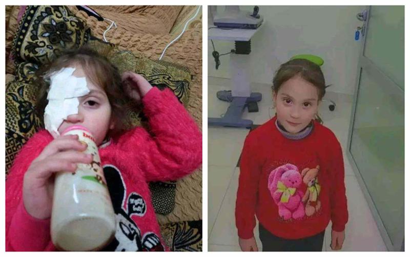 5 წლის ნინი ბერიშვილს საზოგადოების დახმარება ესაჭიროება