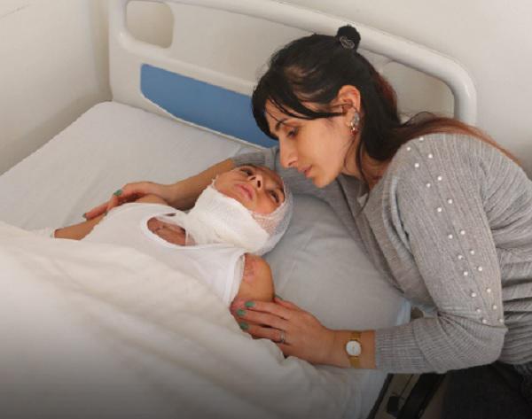 11 წლის ლუკას, რომელსაც პიროტექნიკა აუფეთქდა, საზოგადოების დახმარება სჭირდება