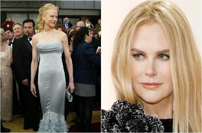 "თინეიჯერობის წლების გახსენება არ მიყვარს..." - თურმე ულამაზეს ნიკოლ კიდმანსაც აწუხებდა გარეგნობასთან დაკავშირებული კომპლექსი