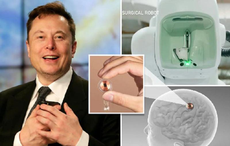 ილონ მასკის განცხადებით, ადამიანის თავში ნეიროჩიპი წარმატებით ჩანერგეს