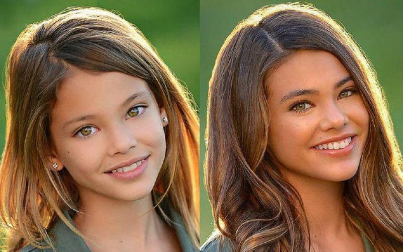 გოგონა "ელფის თვალებით" - როგორ ცხოვრობს და როგორ გამოიყურება გოგონა, რომელსაც წლების წინ მსოფლიოში ყველაზე ლამაზ ბავშვს უწოდებდნენ (ფოტოები)