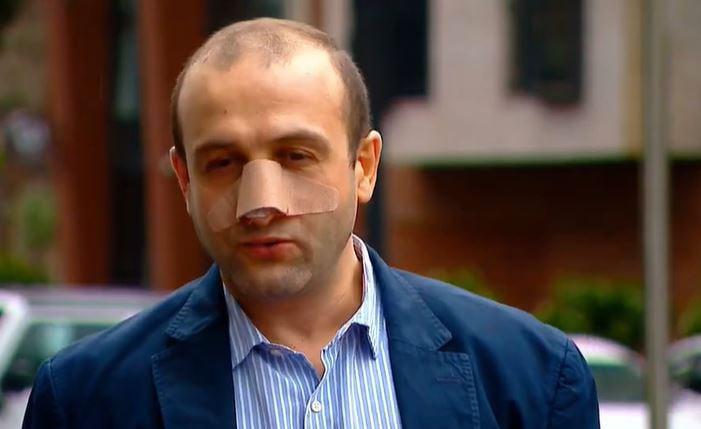 "ბეჭდიანი ხელი მომიქნია და ცხვირში მომხვდა... არც მე დამიკლია" - რას ამბობს იაგო ხვიჩია თავდასხმაზე