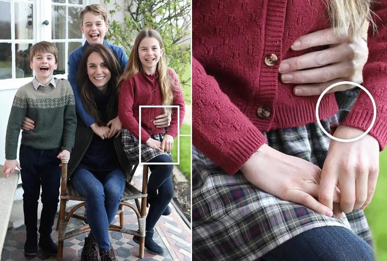 ოპერაციის შემდეგ ქეით მიდლტონმა პირველი ფოტო გამოაქვეყნა, თუმცა ამის გამო ბოდიშის მოხდა მოუწია: პრინცესას სკანდალი გრძელდება