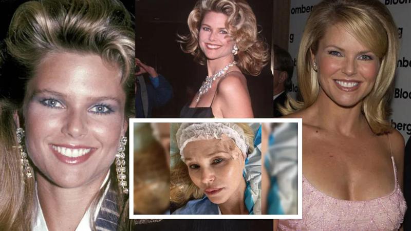 ლეგენდარულ მოდელს სიმსივნე დაუდგინდა - "ჭრილობა ამომიკერეს, თითქოს "დიორის" მაღალი მოდის სამოსი ვყოფილიყავი"