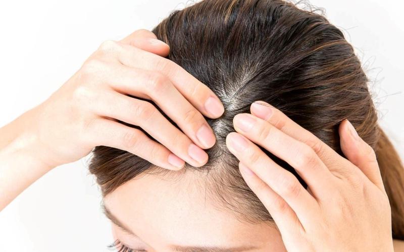 თმის ცვენა, ფრჩხილების სისუსტე, კანის პრობლემები - დანამატები, რომელიც ორგანიზმის გაძლიერებაში დაგვეხმარება