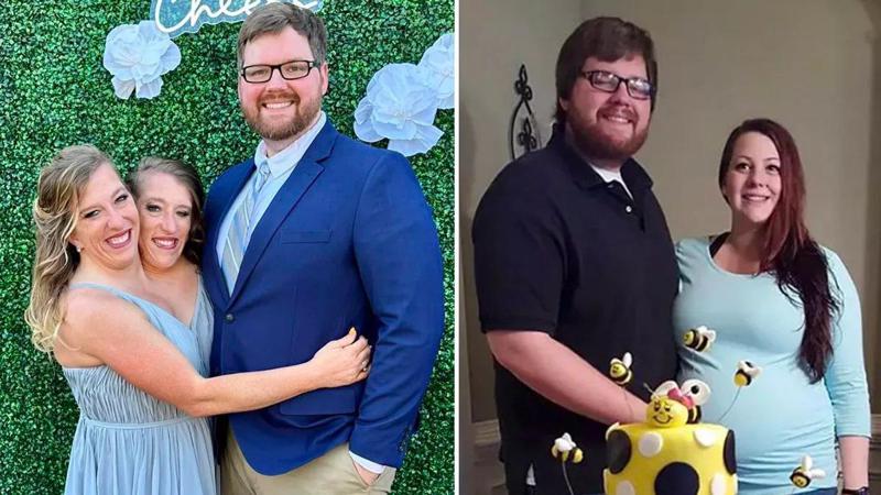 კაცს, რომელიც სიამის ტყუპი დებიდან ერთ-ერთზე დაქორწინდა, ყოფილი ცოლი უჩივის - რა სკანდალში ეხვევა ჯოშუა ბოულინგი?