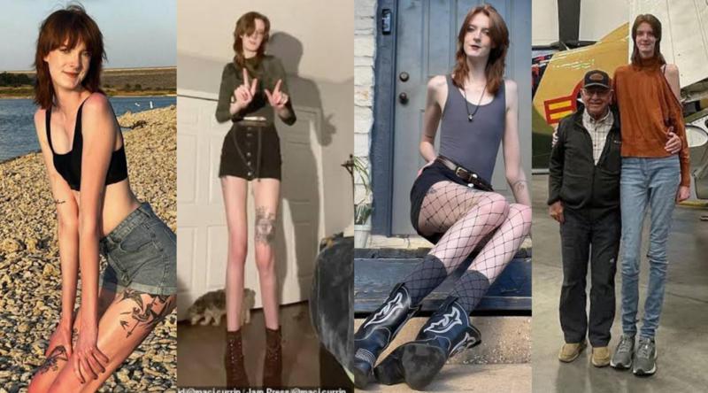 "ისინი უარს ამბობენ ჩემს კოცნაზე!" - გოგონა, რომელსაც მსოფლიოში ყველაზე გრძელი ფეხები აქვს, ამბობს, რომ სიმაღლე შეყვარებულის პოვნაში ხელს უშლის