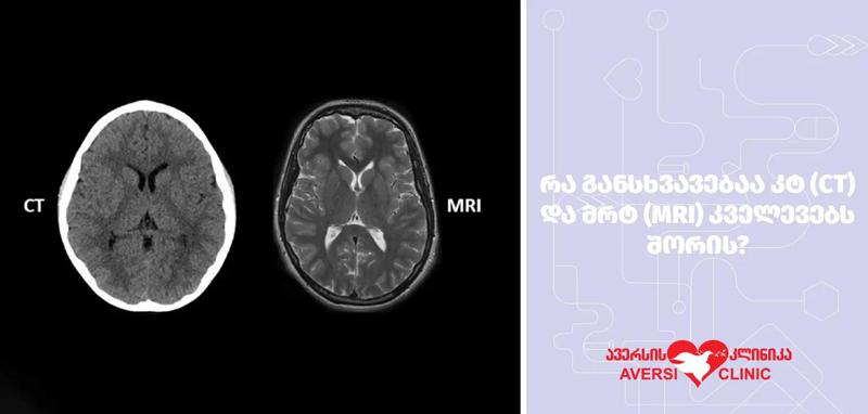 რა განსხვავებაა კტ (CT) და მრტ (MRI) კვლევებს შორის?