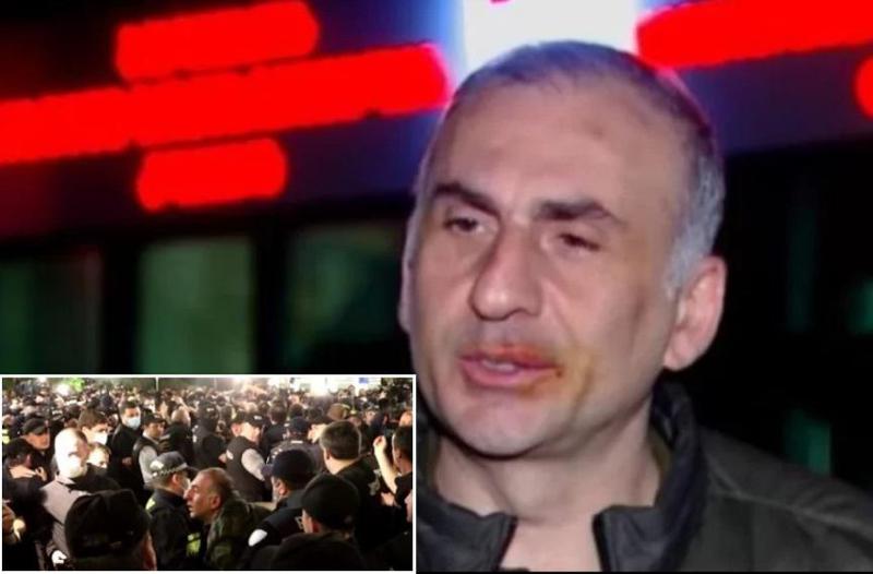 დეპუტატ ალეკო ელისაშვილზე პოლიციელების ძალადობის კადრები ვრცელდება - "შეთრევის დროს წავიქეცი და დაგდებულს მირტყამდნენ" (ვიდეო)