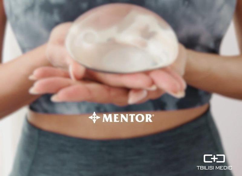რა უნდა გავითვალისწინოთ მამოპლასტიკის გაკეთებისას და როგორ შევარჩიოთ ხარისხიანი იმპლანტი?