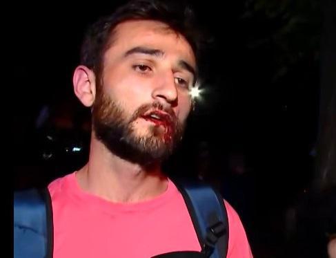 "უჩვეულო ამბავი გადამხდა აქციაზე და უნდა მოვყვე... წამებში გამიკეთეს წრე, შემათრიეს კორდონის შიგნით და გადამიარეს" - რას წერს მოქალაქე?