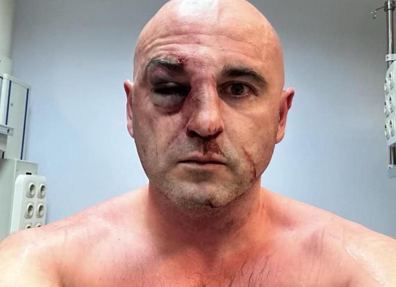 სასტიკად ნაცემი ლევან ხაბეიშვილი - რა ინფორმაცია ვრცელდება "ნაცმოძრაობის" თავმჯდომარის შესახებ?