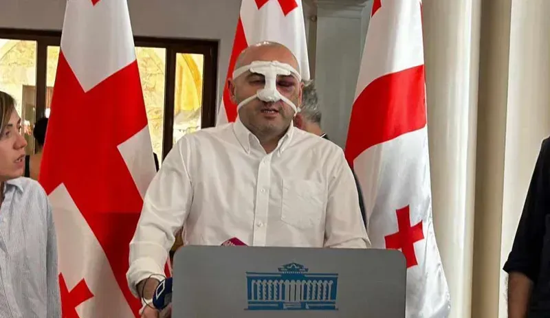 "ხარებას“ ზონდერ ჯგუფები მიზანმიმართულად მისწორდებოდნენ რამდენიმე წუთის განმავლობაში, ითხოვდნენ მეთქვა, რომ "დამნაშავე და ცუდი ადამიანი ვარ“ - ლევან ხაბეიშვილი