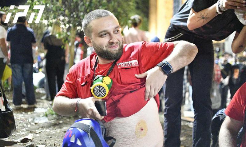 "გვერდში მომხვდა რაღაც, ძალიან მეტკინა და ჩავიკეცე... გვერდიდან არის რეზინის ტყვია შემოსული..." - რას ჰყვება "პალიტრანიუსის" ჟურნალისტი, რომელიც აქციაზე დაშავდა