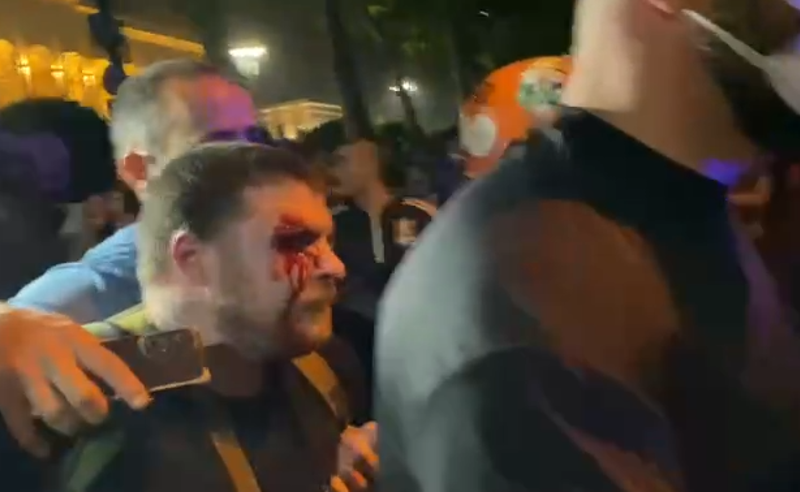 "როგორც ექიმებმა მითხრეს თვალი გადარჩა, რეზინის ტყვია წარბის არეში აქვს მოხვედრილი" - რას ამბობს აქციაზე დაზიანებული ბიჭის მამა?