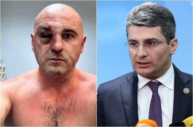 "რაც არ უნდა მიუღებელი იყოს პოლიტიკოსი, მისი დაზიანებული სახის ყურება ძალიან უსიამოვნოა - არ ვამართლებ, მაგრამ პოლიციელებიც ადამიანები არიან, ვაჟკაც ბიჭებს დედის სისხლს რომ აგინებენ, როგორი მოსათმენია?" - მდინარაძე ხაბეიშვილზე