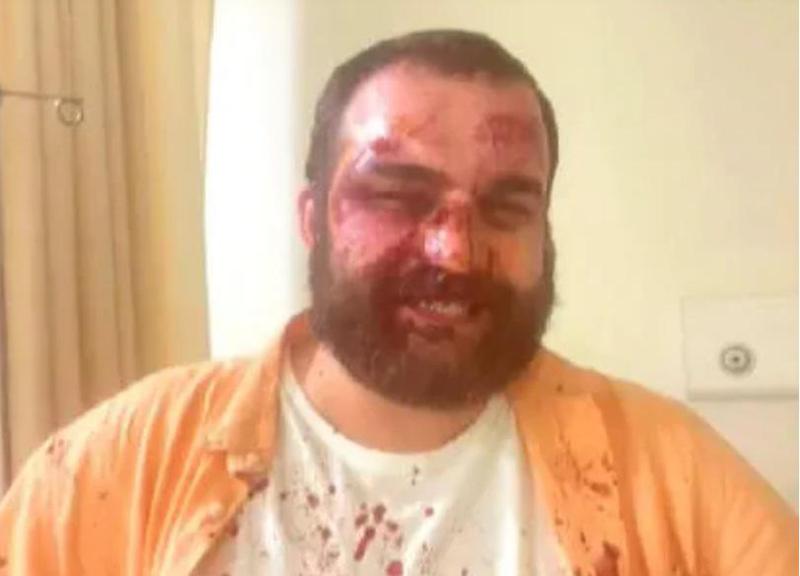 დიმიტრი ჩიქოვანს საკუთარ სახლთან თავს დაესხნენ - "ქართული ოცნების" მშიშარა "ტიტუშკები" ზუსტად 3 წუთში გაიქცნენ"