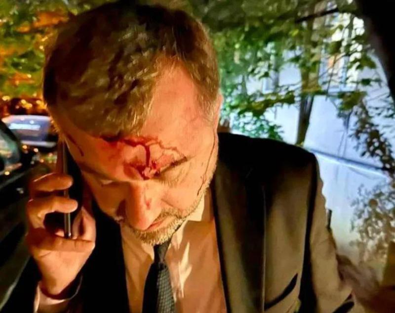 ზურაბ ჯაფარიძე: "ჩემს ძმას სადარბაზოსთან რამდენიმე ადამიანი დახვდა და ფიზიკურად გაუსწორდა"