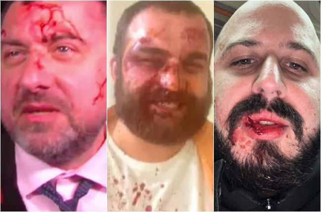 წუხანდელი თავდასხმების ქრონიკა - რა დაზიანებები აღენიშნებათ დაზარალებულებს?