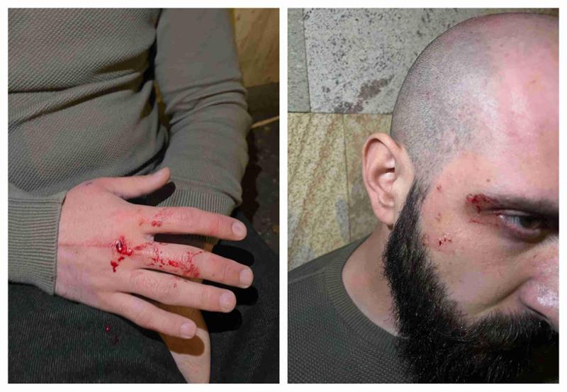 "მცემეს, მეც ვურტყი, მაგრამ ყველას რაღაც ეჭირა და მომერივნენ... ძალიან ცუდად იმალებოდა..." - რას წერს ბორის ჩელე ყურუა?