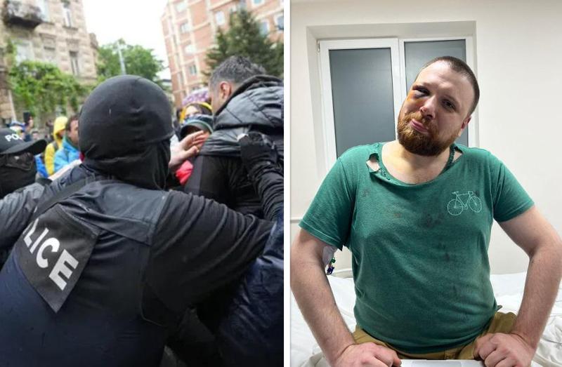 რა ფოტოს აქვეყნებს კლინიკიდან მოქალაქე, რომელსაც სამართალდამცველებმა სასტიკად სცემეს?