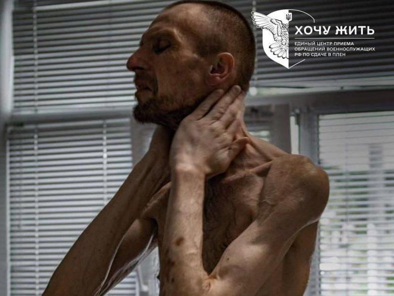 ჯოჯოხეთური 2 წელი რუსეთის ტყვეობაში: "ის სამოქალაქო პირია და არასდროს უბრძოლია" - ვრცელდება რომან გორილიკის შოკისმომგვრელი ფოტოები