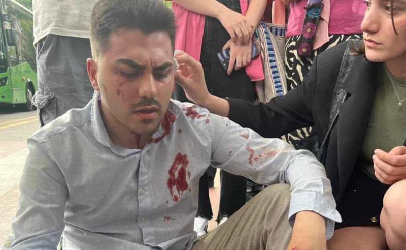 სტუდენტური მოძრაობა "თავისუფლებისთვის“ ლიდერ 21 წლის ნიკო მანაგაძეს ფიზიკურად გაუსწორდნენ - "ავტობუსის გაჩერებისკენ მოვდიოდი, უკნიდან ჩარტყმა ვიგრძენი"