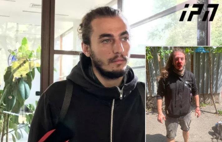 "შენ თუ თავში არ გესროლოო, მეძახდა სამიდან ერთი, როცა დაგდებულს მირტყამდა" - რას წერს ზუკა ბერძნიშვილი