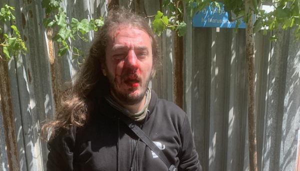 “სამნი იყვნენ, მანქანით ელოდებოდნენ, ზურგიდან მიეპარნენ...“ - სამოქალაქო აქტივისტ ზუკა ბერძენიშვილს თავს დაესხნენ: რა დეტალები ხდება ცნობილი?