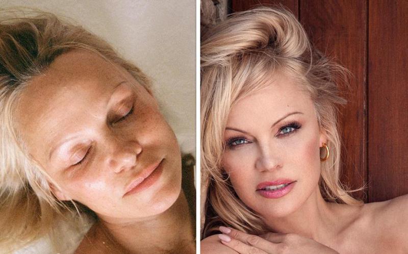 არანაირი ბოტოქსი - როგორ ინარჩუნებს 56 წლის პამელა ანდერსონი სახის იდეალურ კანს? ვარსკვლავის კოსმეტოლოგი საიდუმლოს ამხელს