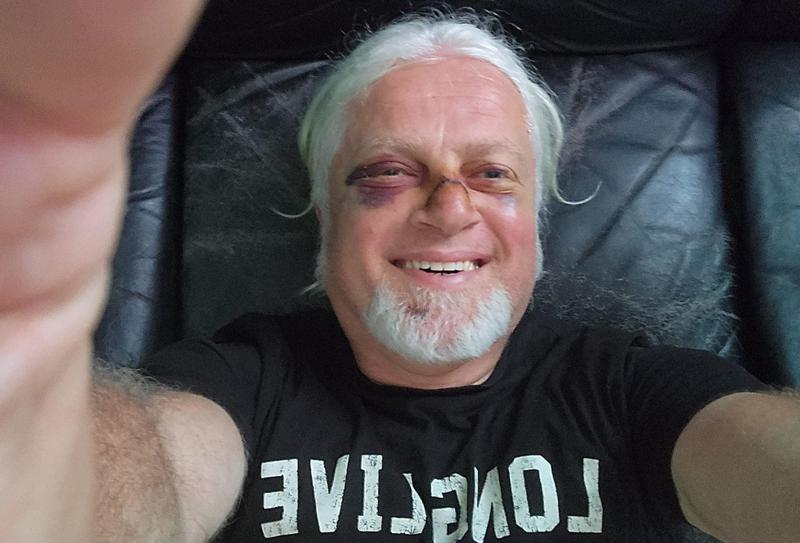 "ცხვირი მომძვრა, მიმაკერეს... ბედად იქ შორეული მეგობარი აღმოჩნდა, რომელმაც საავადმყოფოში მიმიყვანა" - რა შეემთხვა ლადო ბურდულს?