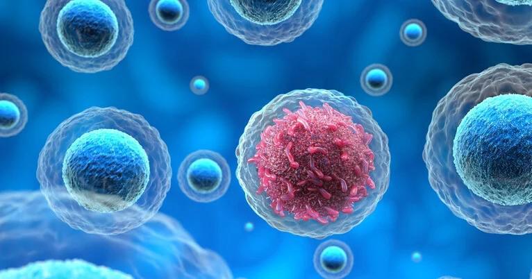 ცხოვრების 6 წესი, რომელიც, ხშირ შემთხვევაში, კიბოს იწვევს: აშშ-ის კიბოს საზგადოების ახალი კვლევის შედეგები