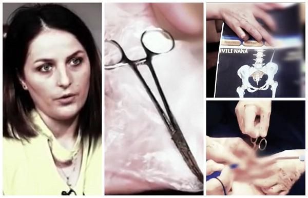 “ასე ვატარებდი მაკრატელს 2 წელი მუცლით, ელენთა ამოიღეს და “ზაჟიმი“ ჩამიტოვეს“ - რას ჰყვებიან პაციენტი და ქირურგი მძიმე შემთხვევის შესახებ(ვიდეო)