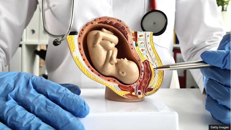 როგორი იქნება ხელოვნური პლაცენტა, რომლის შექმნასაც აშშ-ში გეგმავენ - შანსი ნაადრევად დაბადებული ბავშვების გადასარჩენად თუ "ცუდი სამეცნიერო ფილმი"?