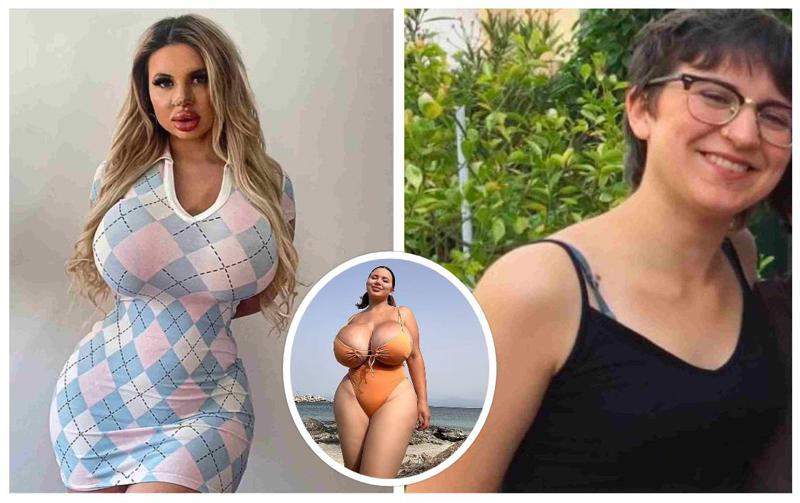 23 წლის ინფლუენსერმა მკერდის ოპერაციაში 40 000 დოლარი დახარჯა, თუმცა ამბობს, რომ მისი "მასიური მკერდი მამაკაცებს აფრთხობს" - როგორ გამოიყურება ის?