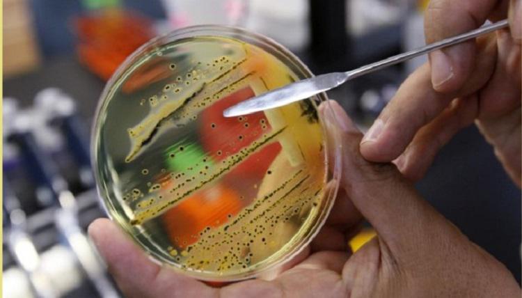 რესტორანში კვების შემდეგ, 6-დან სამს სალმონელოზი დაუდასტურდა - სურსათის ეროვნული სააგენტო დეტალებს ავრცელებს