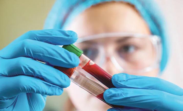 რა ანალიზები უნდა გავიკეთოთ ყოველწლიურად?