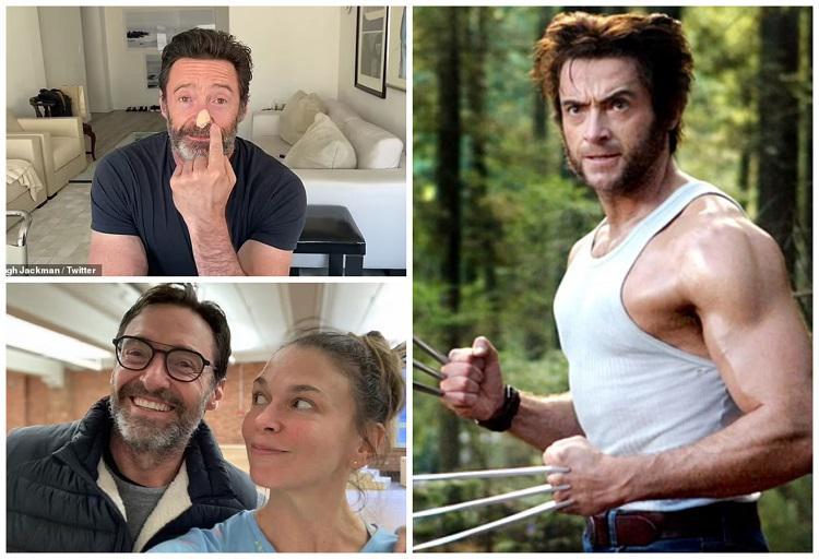 “საკმაოდ შეშინებული ვიყავი... ძალიან გთხოვთ, გამოიყენეთ მზისგან დამცავი“ - ჰიუ ჯეკმანის ბრძოლა სიმსივნესთან, დასრულებული ქორწინება და ახალი რომანი