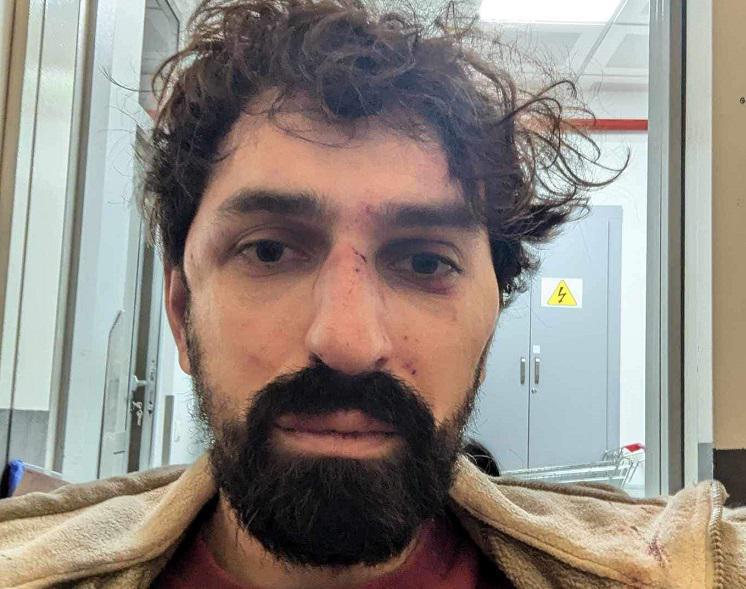 “სასტიკად სცემეს, სავარაუდოდ გატეხილი აქვს ცხვირი, წაართვეს კამერები“ - “პუბლიკას“ ინფორმაციით, საპროტესტო აქციაზე ჟურნალისტი, ალექსანდრე ქეშელაშვილი დააკავეს